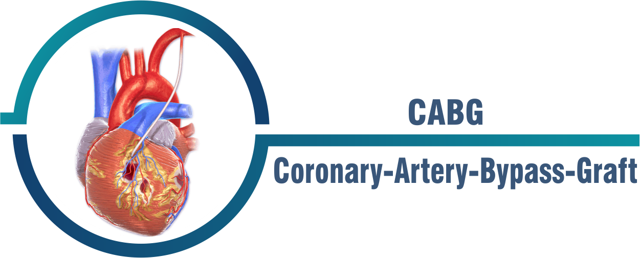 Heart Bypass Surgery at Livasa Mohali - Expert Cardiac Surgeons